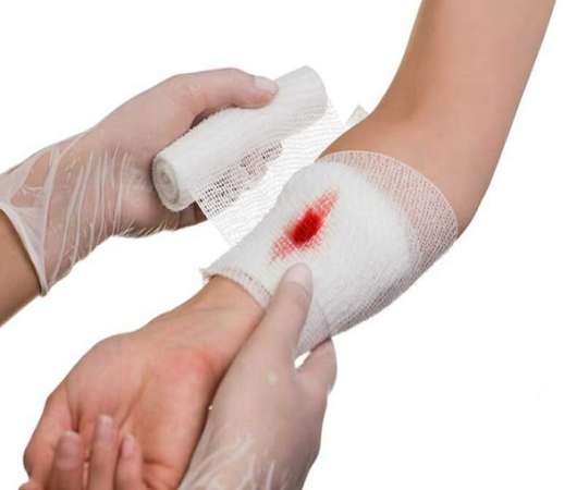 تحقیق در مورد خونریزی و زخم ها تحقیق در مورد خونریزی و زخم ها
