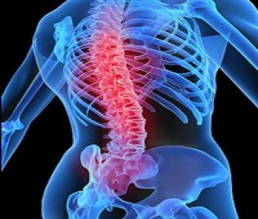 مقاله درباره صدمات ستون فقرات